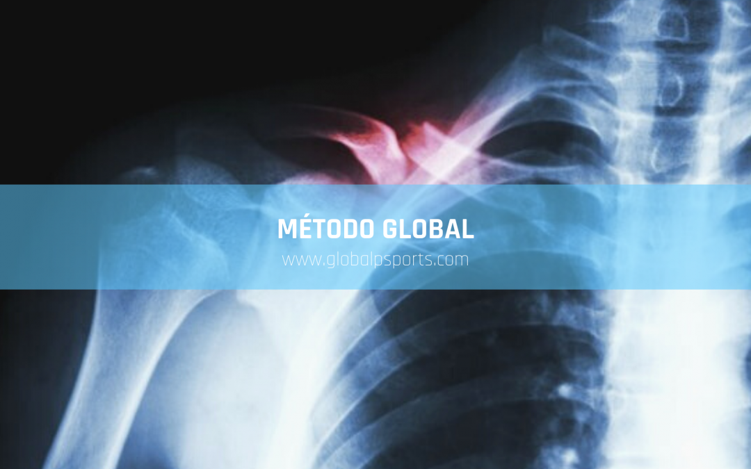 El método Global: Cómo recuperarse de una lesión